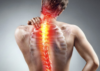 Pain O Soma 500 for Muscle Soreness: Understanding Its Role