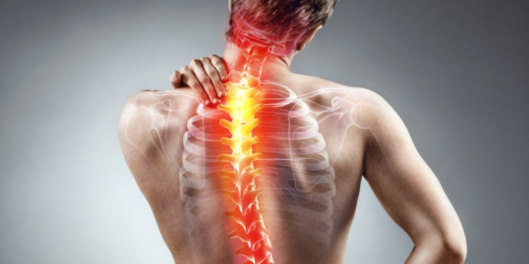 Pain O Soma 500 for Muscle Soreness: Understanding Its Role