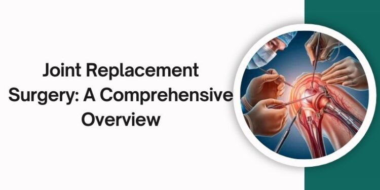  Joint Replacement Surgery:A Comprehensive Overview