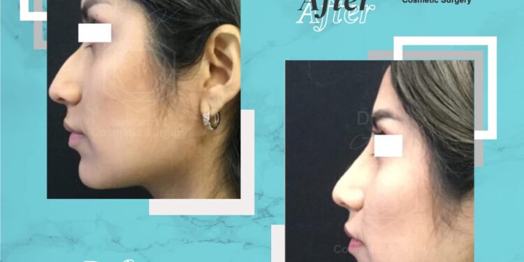 Cosmetic surgery Islamabad
