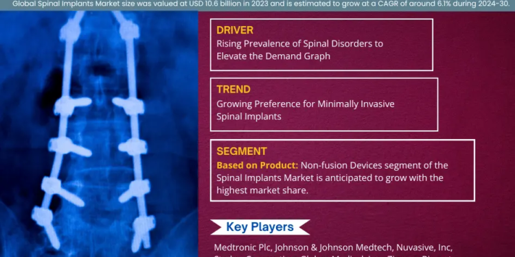 Spinal Implants Market Expected to Grow at 6.1% CAGR | Key Trends & Forecast to 2030