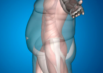 What Are the Long-Term Nutritional Challenges After Bariatric Surgery in Dubai