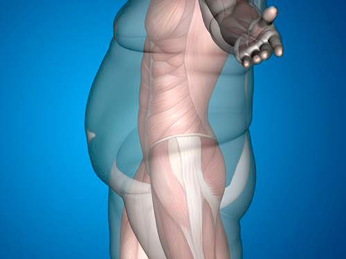 What Are the Long-Term Nutritional Challenges After Bariatric Surgery in Dubai