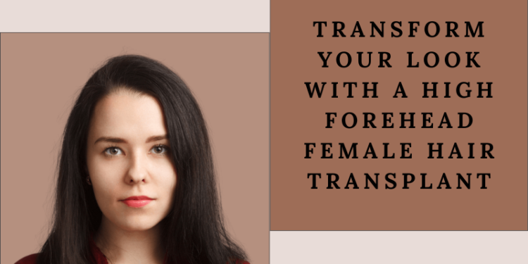 high forehead female hair transplant