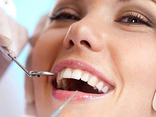 Permanent Dentures Tampa