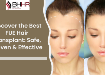Discover the Best FUE Hair Transplant: Safe, Proven & Effective
