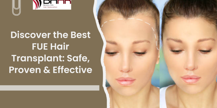 Discover the Best FUE Hair Transplant: Safe, Proven & Effective