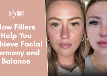 facial balancing with fillers