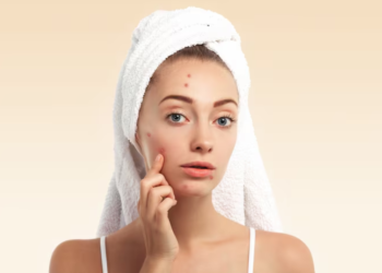 best acne products