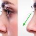 best rhinoplasty in islamabad