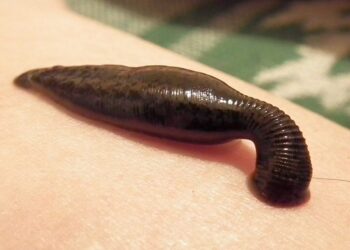 Medicinal Leech Therapy in Mumbai: A Natural Gift for Modern Illnesses
