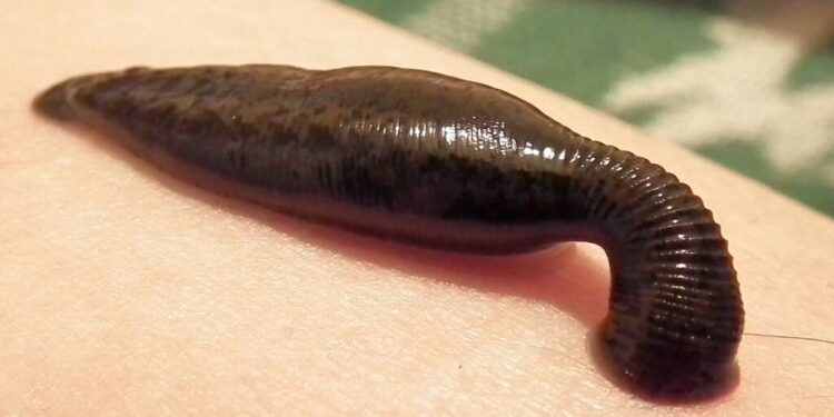 Medicinal Leech Therapy in Mumbai: A Natural Gift for Modern Illnesses