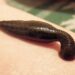 Medicinal Leech Therapy in Mumbai: A Natural Gift for Modern Illnesses