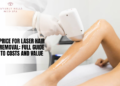 price for laser hair removal